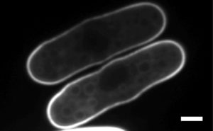 Fission yeast cells Expressing the PS marker LactC2