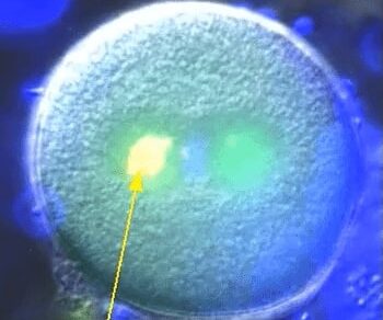 Tilting mitotic spindles with in vivo magnetic tweezers